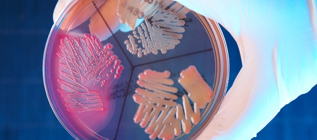 medical bacteria in clear container